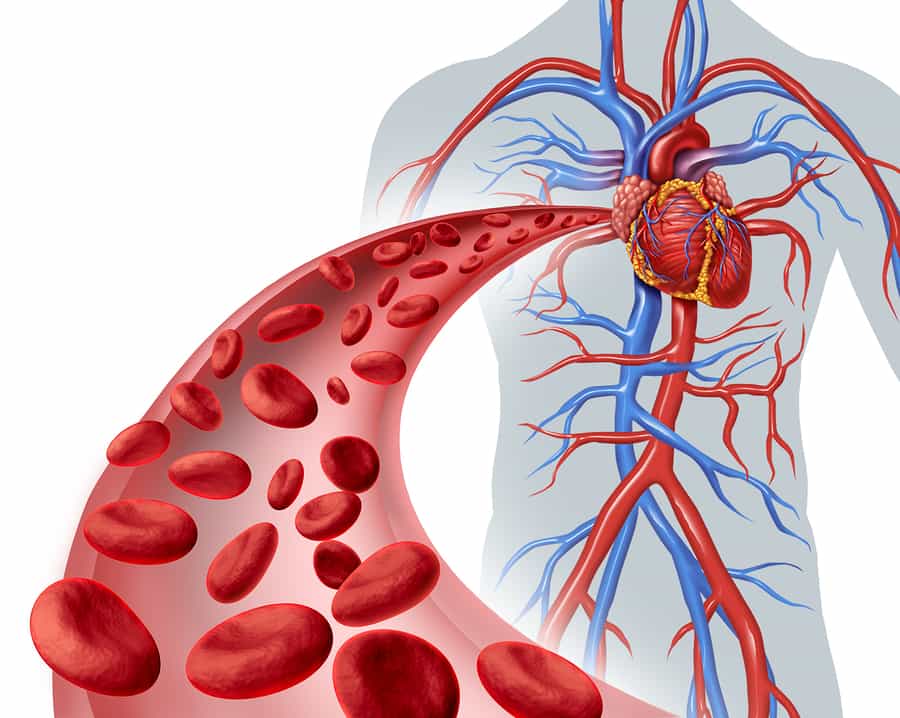 heart heath,small vessel stenosis, acupuncture melbourne