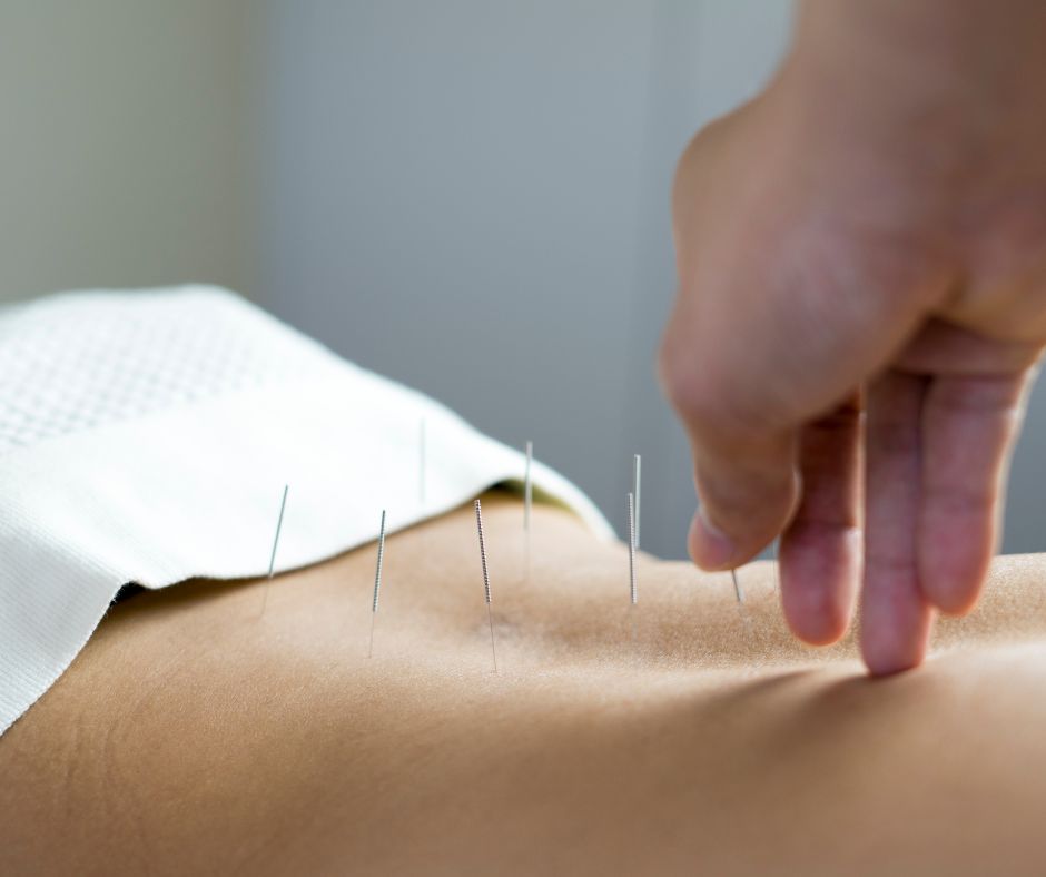 Acupuncture Melbourne 1