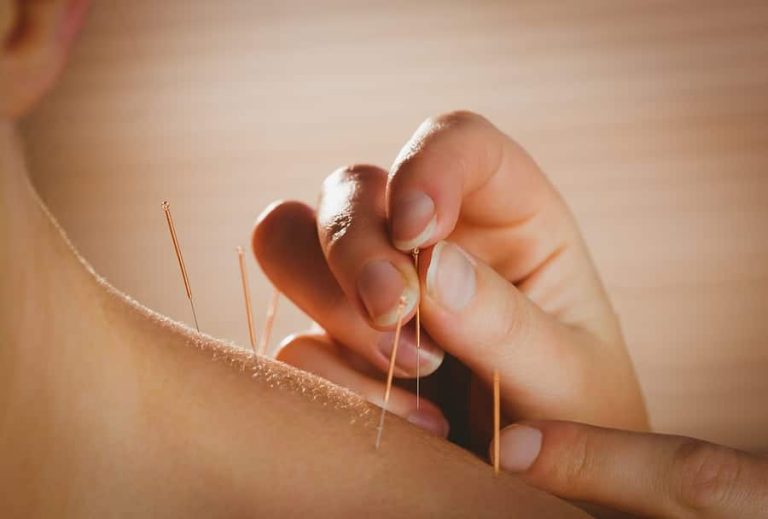 acupuncture melbourne
